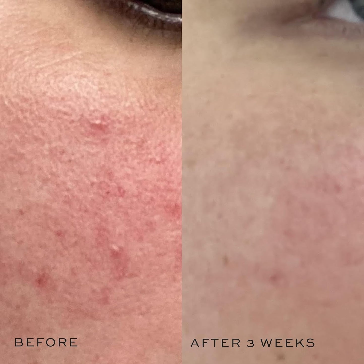 DIME Beauty Super Skin Toner, Alcohol-Free Witch Hazel Toner, Hydrating for Face with Aloe Vera and Cucumber Extract, 4 oz / 120 ml