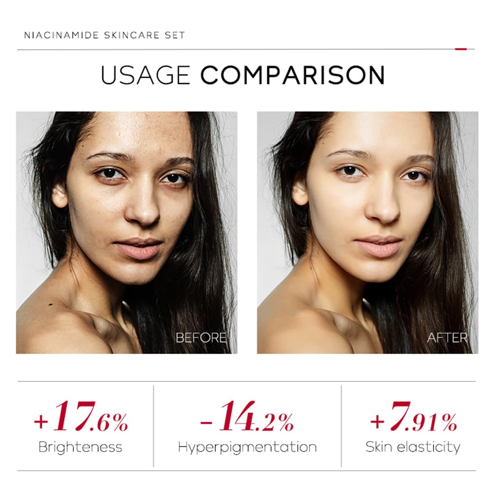 Niacinamide Skincare Set: 4pcs Beauty Kit with Cleanser, Toner, Serum, & Facial Cream - Hydrates & Evens Skin Tone - TSA-Friendly Travel Sizes, Perfect Gift for Women, Moms, & Teens