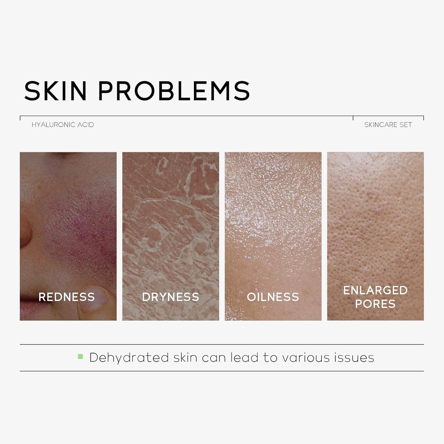 Hydrating Skin Care Set, Hyaluronic Acid Skin Care Kit with Serum for Face, Moisturizer, Travel Size Face Care Set for Women, Anti Aging Plumping Hydrating Firming for Dry Skin