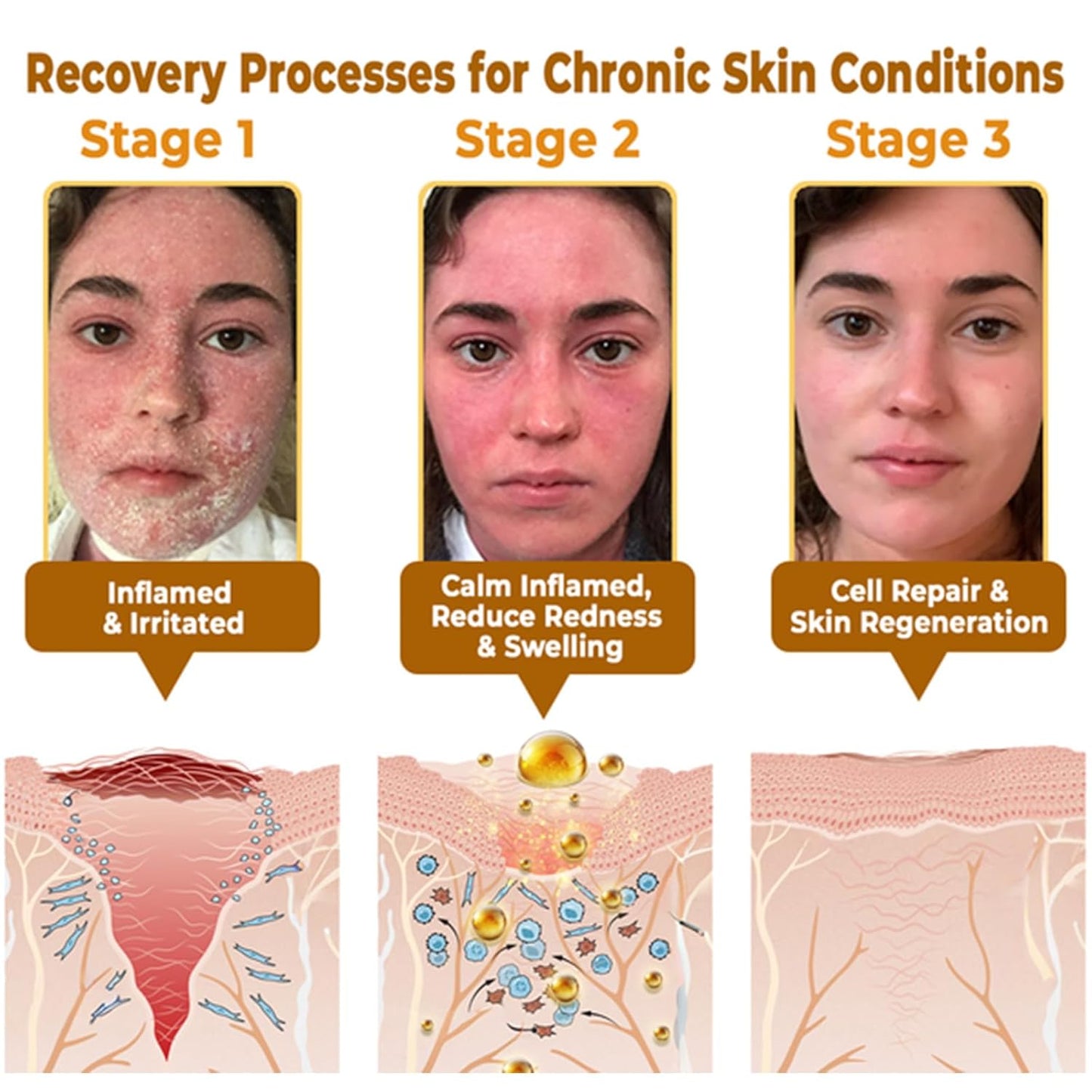 Bee Venom Skin Restoration Cream, Bee Venom Skin Treatment Cream, Repair skin and Firming, Effective In Reducing Blemishes (3)