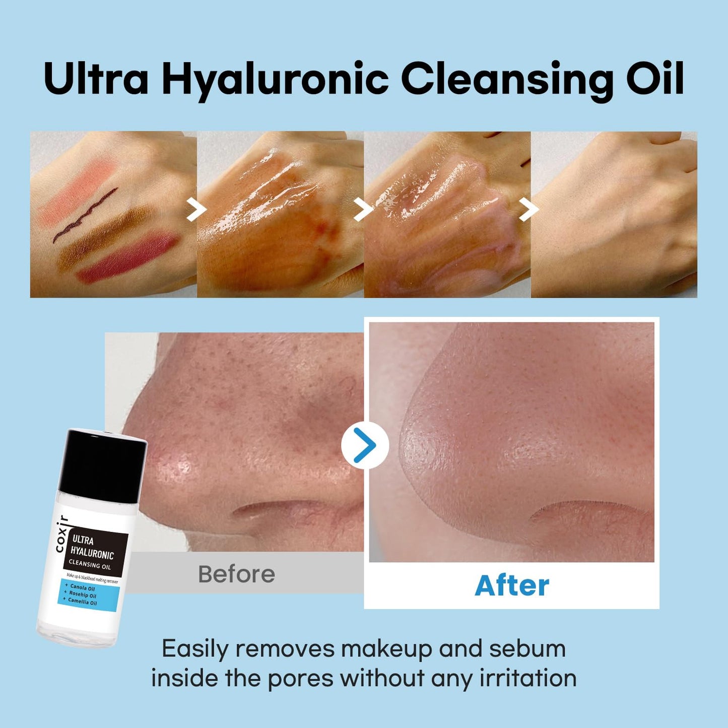 coxir ULTRA HYALURONIC STARTER KIT /cleansing oil+toner+ampoule+cream tralvel kit/[2.68 fl.oz (Pack of 1)]