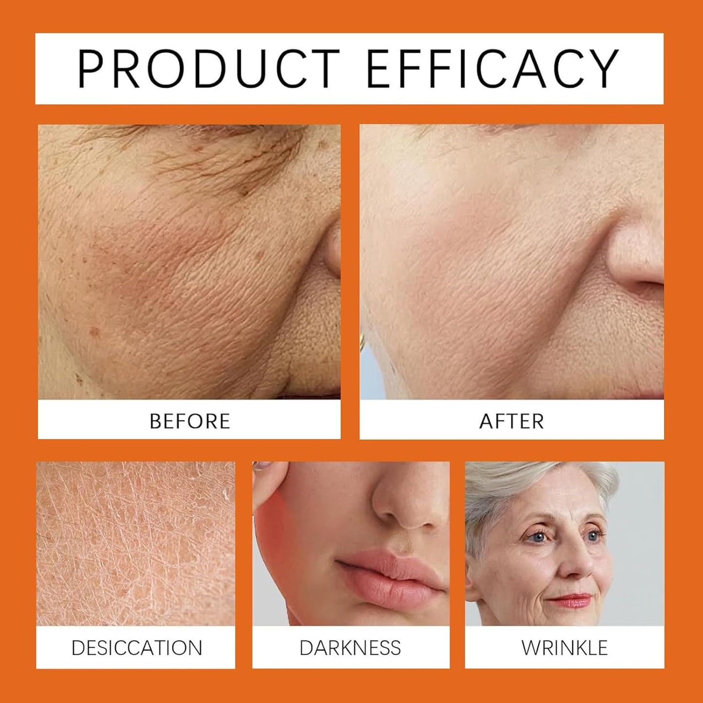 Bee Venom Comprehensive Cream, Professional bee venom cream for Removing and Repair, Bee Venom Skin Treatment Cream, Natural Serum Suitable for All Skin Types (1 Pack)