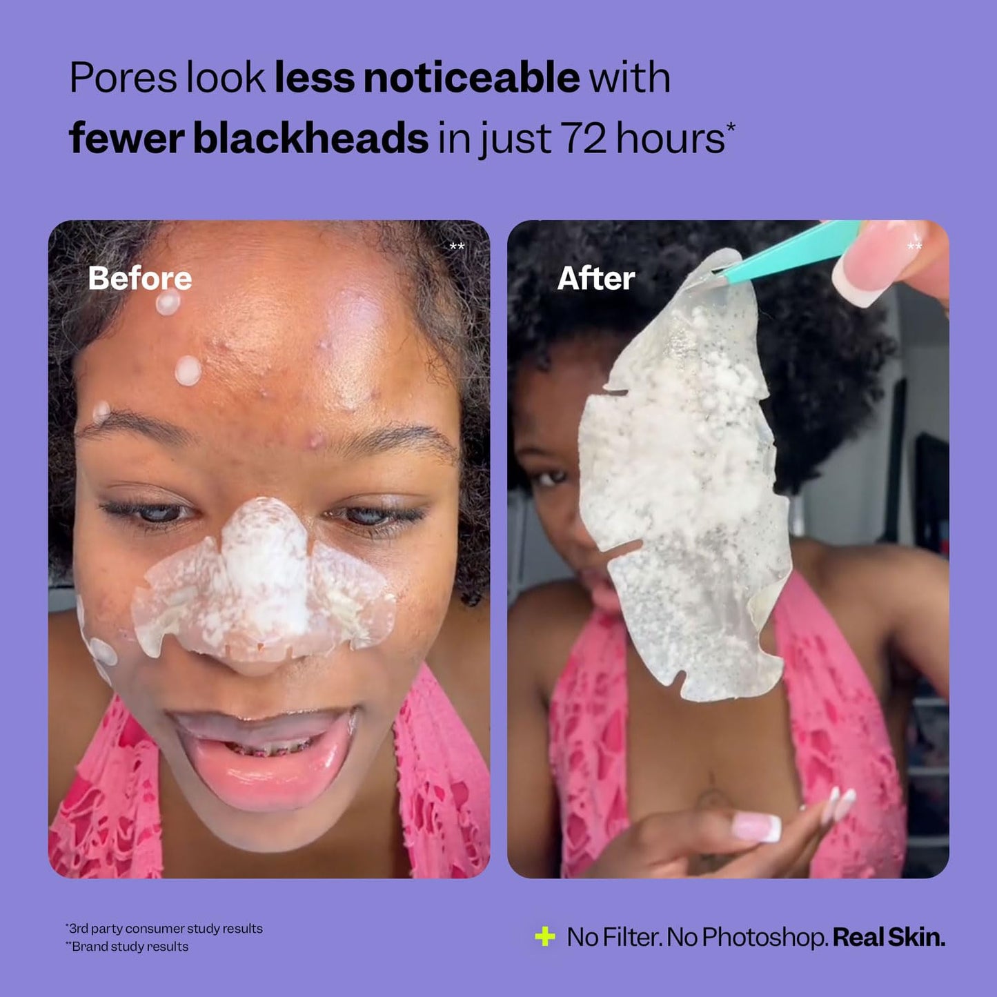 Peach Slices | Nose Pore Patches | Medical-Grade Hydrocolloid | Targets Pores & Pimples | Absorbs Oil Overnight | Vegan | Cruelty-Free | Facial Skin Care Products | 7 Ct