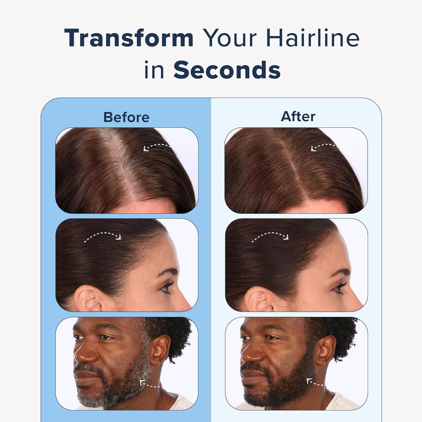 TRUHAIR Color & Conceal Waterproof Root Touch Up Hair Color Concealer - Hair Cover up for Gray Coverage and Hairline Filling - 11 Hair Colors Available (Light Blonde)