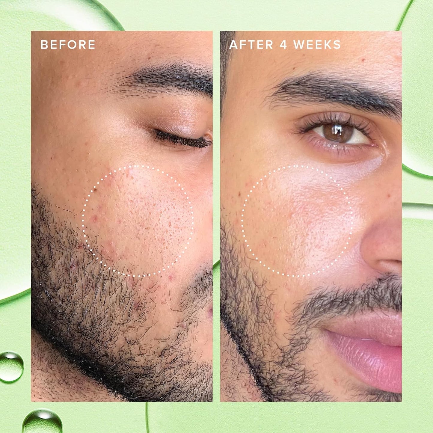 Farmacy 2% Salicylic Acid Toner for Face - Deep Sweep Gentle BHA Exfoliant for Oily Skin - Refines Texture with Papaya Enzymes & Moringa Water for a Healthy-Looking Complexion (10ml)